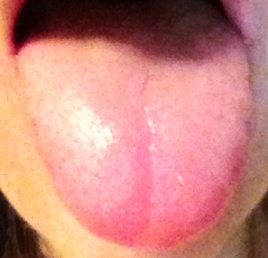 tongue TCM health