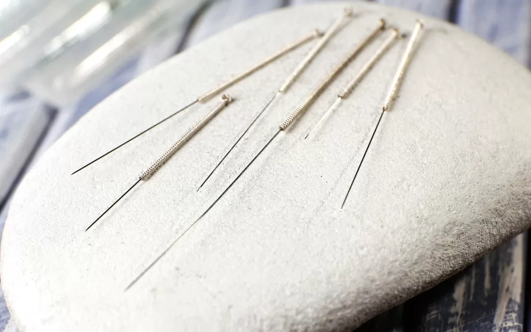 does acupuncture hurt painless acupuncture needles