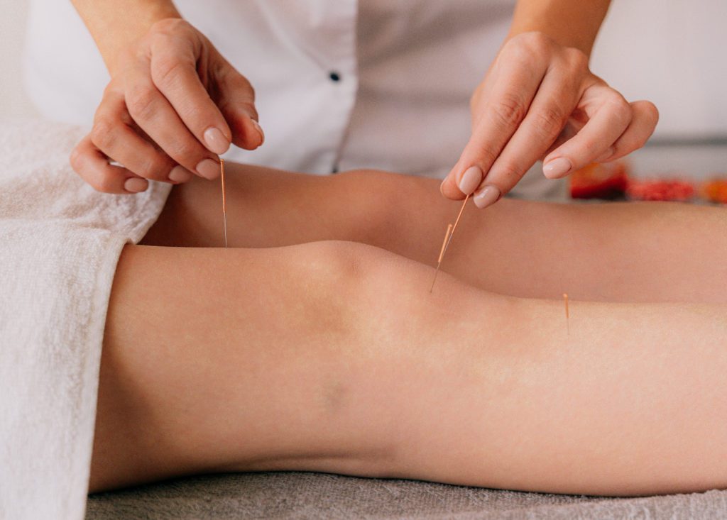 knee acupuncture vancouver bc pain relief knee